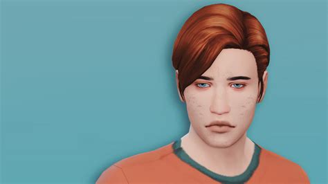 Best Sims 4 Acne Skin Cc Details All Free Fandomspot