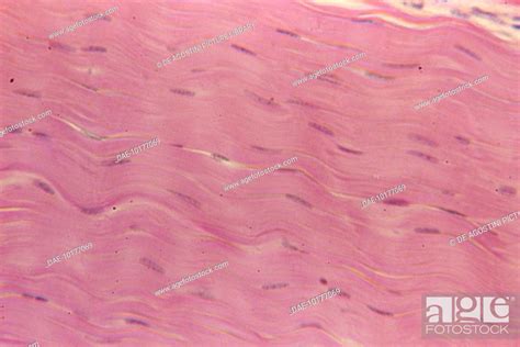 Microphotograph Of A Section Of Fibrous Connective Tissue Of Human