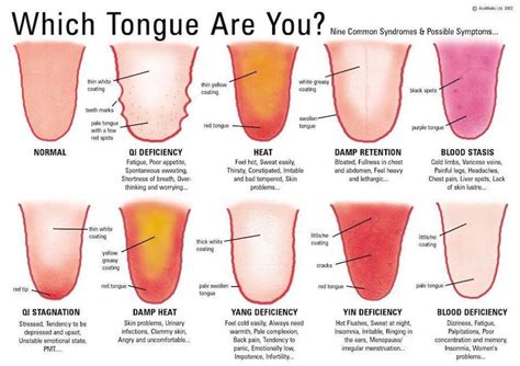 10 Warning Signs Your Tongue May Be Sending You About Your Health