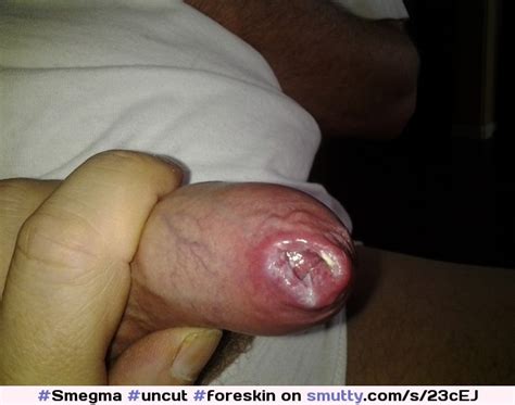Uncut Foreskin Smegma Smutty Hot Sex Picture