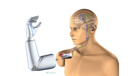 Bone basics and bone anatomyhave you ever seen fossil remains of dinosaur and ancient human bones in textbooks, television, or in person at a muscles often attach to two different bones, so that when the muscle flexes and shortens, the bones move. This guy has the first prosthetic arm directly connected ...