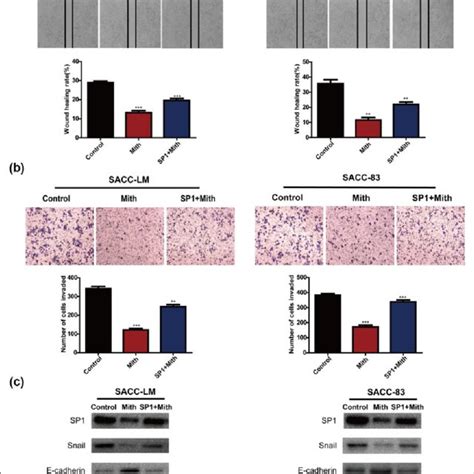 expression of sp1 in human salivary adenoid cystic carcinoma tissues download scientific