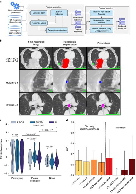 Extraction Of CT Radiomics Features And Association With Response A