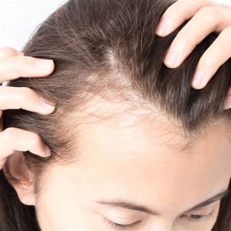 The One Supplement You Should Never Take Because It Causes Instant Hair