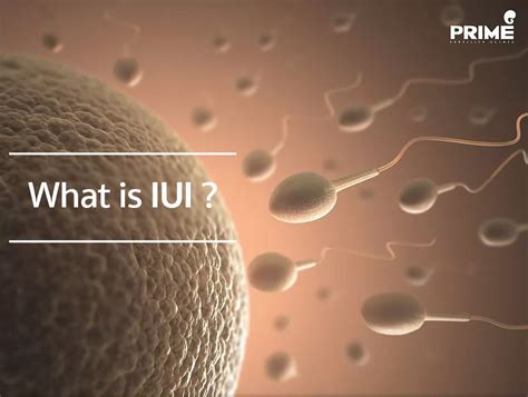 What Is Iui Prime Fertility Center Drpoonkiativficsifertility Clinic