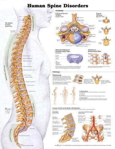 Free printable reflexology charts | anatomy and health charts. Human Spine Disorders Anatomical Chart Poster Print Pôsters na AllPosters.com.br