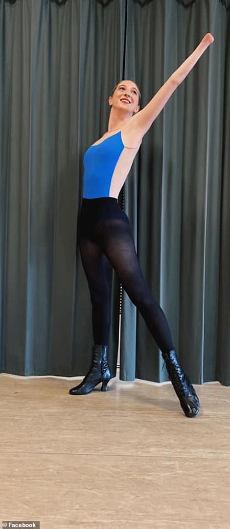 Dancer 22 Born With One Hand Makes Radio City Rockettes History
