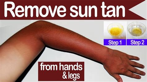 Sun Tan How To Remove Sun Tan From Hands And Legs Naturally At Home Steps Mask Oil