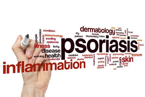 Causes Of Psoriasis Role Of The Immune System And Natural Treatments