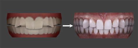 👽 Default Non Default Additional Maxis Teeth Update 19112020
