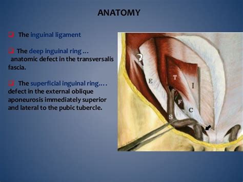 Imaging Of Inguino Scrotal Region