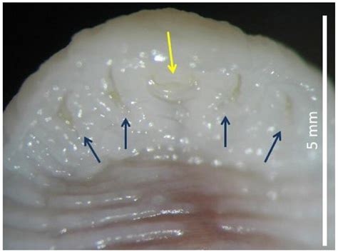 Ventral View Of Anterior End Of Linguatula Serrata With Mouth Yellow
