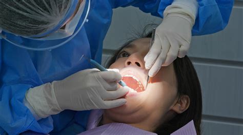 Scaling And Root Planing Forest And Ray Dentists Orthodontists