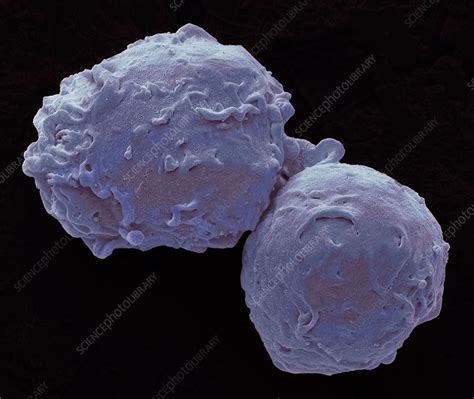 Human Monocytes Sem Stock Image C0200697 Science Photo Library