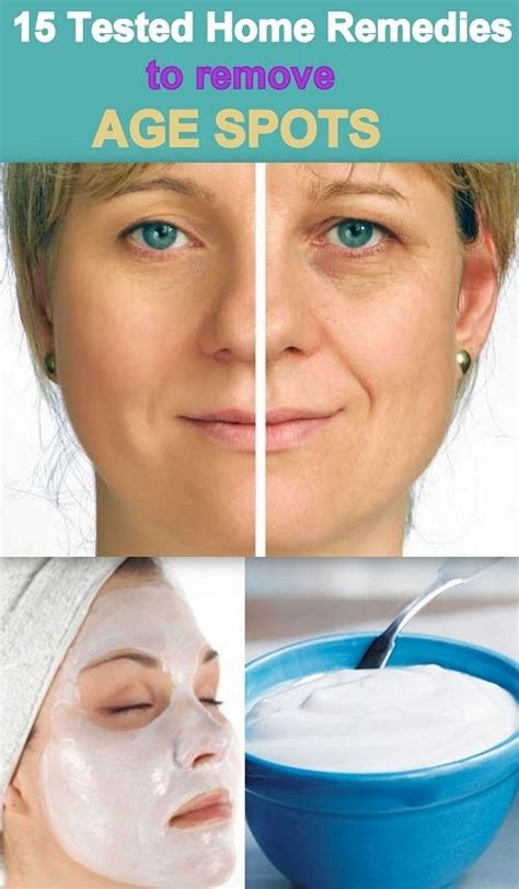 15 Useful Home Remedies For Removing Age Spots With Images Beauty