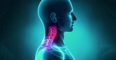 Fractures Of The Neck Scottsdale Az Orthopedic Spine Surgery