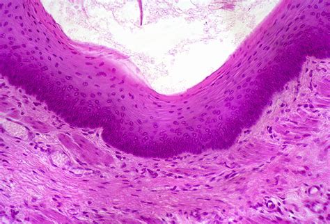 Stratified Squamous Epithelium Lm Photograph By Rober