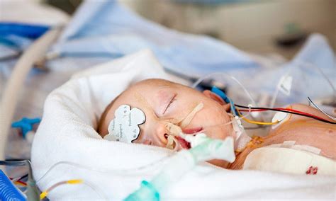Hypoxic Ischemic Encephalopathy Hie Signs And Symptoms
