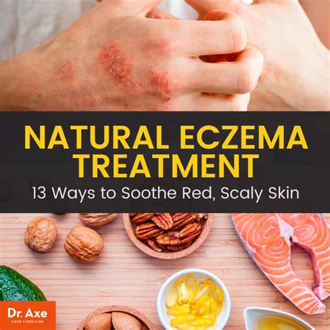 What essential oils are good for eczema? 13 Best Natural Eczema Treatment Options - Dr. Axe