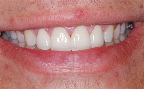 Orchard Heights Dental — Orthodontics