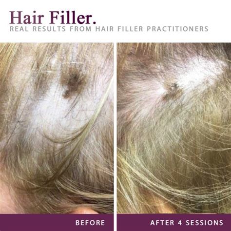 Hair Filler Proactive Sa