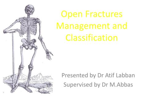 Ppt Open Fractures Management And Classification Powerpoint
