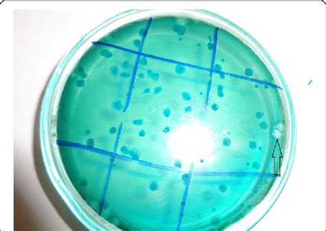 Bacillus Cereus Colonies At 10 −6 Dilution On Bacillus Cereus Selective