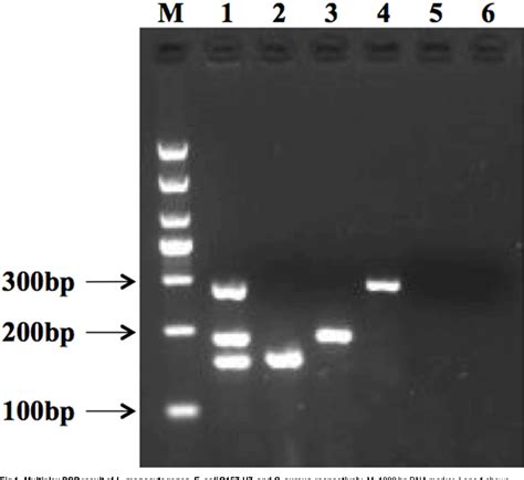 Figure 1 From A Dual Filtration Based Multiplex Pcr Method For Simultaneous Detection Of Viable