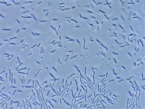 E Coli Bacteria Light Microscopy Stock Video Clip K0049042