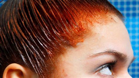How To Remove Hair Dye From Skin 8 Ways To Fix Hair Dye Stains