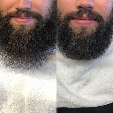 Before And After A Beard Trim Beards