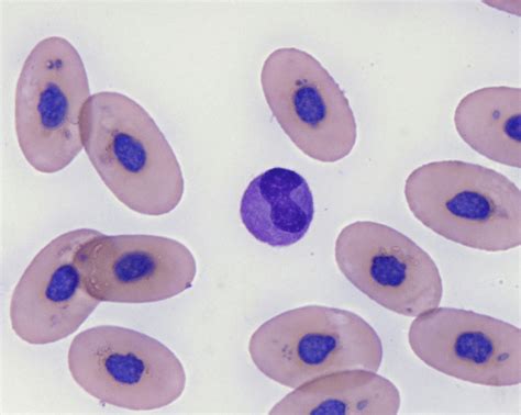 Monocyte Azurophil Modified Wrights Stain 1000 Download
