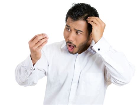 Here's how you can use amla for hair loss. 11 Simple But Powerful Remedies To Stop Hair Loss In Men ...