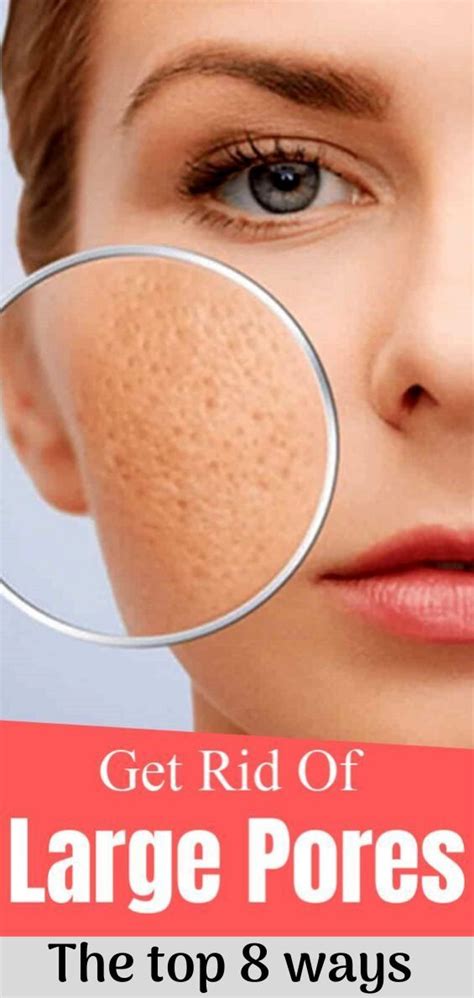 How To Get Rid Of Large Pores The Top 8 Ways Get Rid Of Pores Big