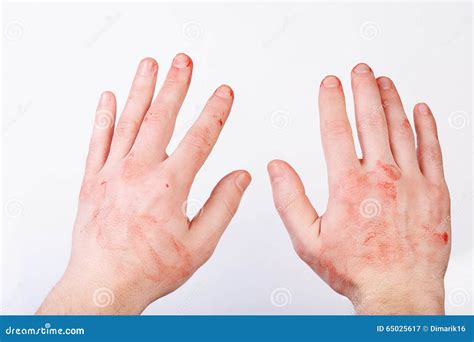 Hands In Covered With Blood Stock Image Image Of Bloody Murder 65025617