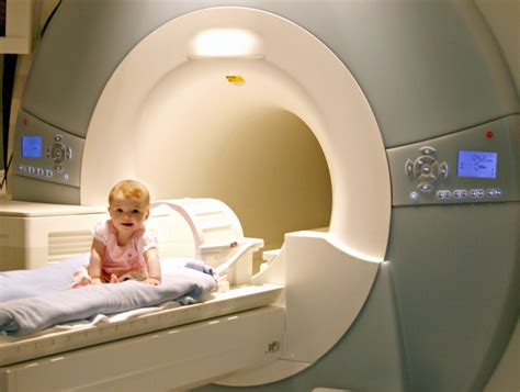 Brain Scans Detect Signs Of Autism In High Risk Babies Before Age 1