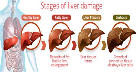 Tests that examine the liver and the blood are used to detect. 15 Warning Signs That Your Liver Isn't Functioning Properly