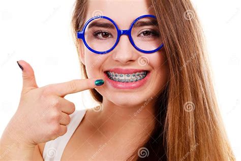 Nerdy Woman Showing Her Teeth With Braces Stock Image Image Of School