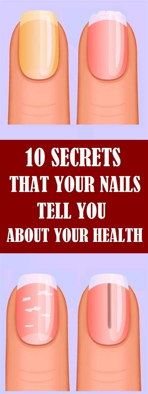 10 Secrets That Your Nails Tell You About Your Health Health Health
