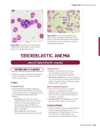 Sideroblastic Anemia Video Anatomy And Definition Osmosis