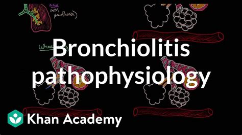 Bronchiolitis Pathophysiology Respiratory System Diseases Nclex Rn