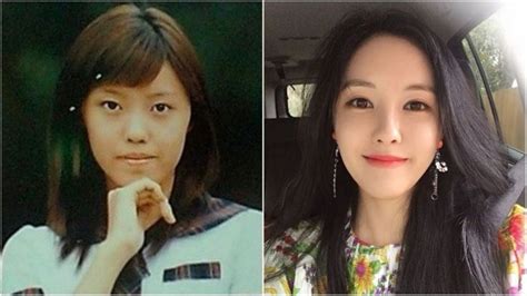 K Pop Stars Before And After Plastic Surgery Nicki Swift Plastic
