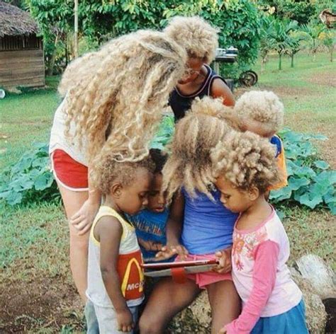 Melanesian Blondes Black People With Natural Blonde Hair About A Quarter Of The Melanesian