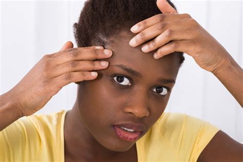 Things To Ask Your Dermatologist As A Black Person