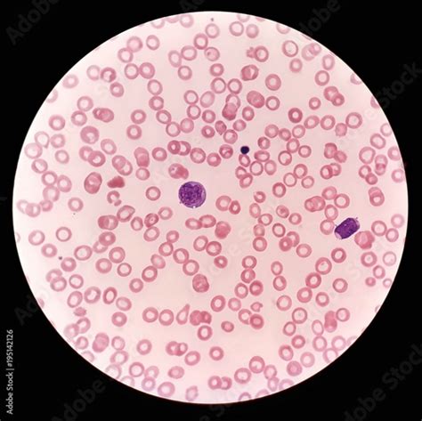 Red Blood Cell Light Microscope