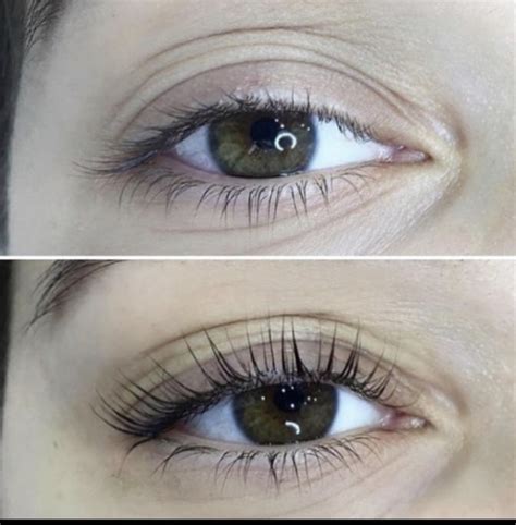 This is a revolutionary technique that can dissolve local fat. Hyaluron Pen Fillers, Fat Dissolving, Lash Lift and Brow ...