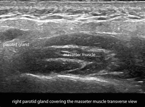 Layers Of Skin Ultrasound