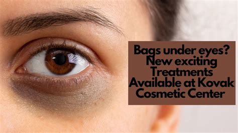 Non Surgical Eye Lifts In Chicago Under Eye Bags Removal And Treatment