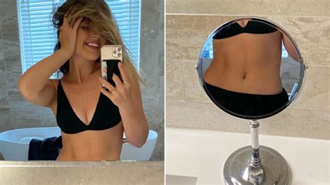 Perrie Edwards Showered In Praise As She Shows Off Stomach Scar In