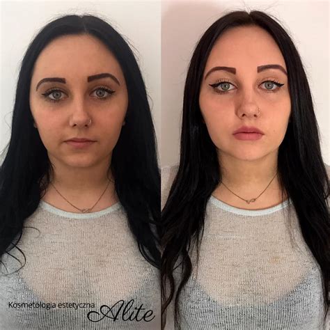 Alite - Zdjęcia (przed i po)